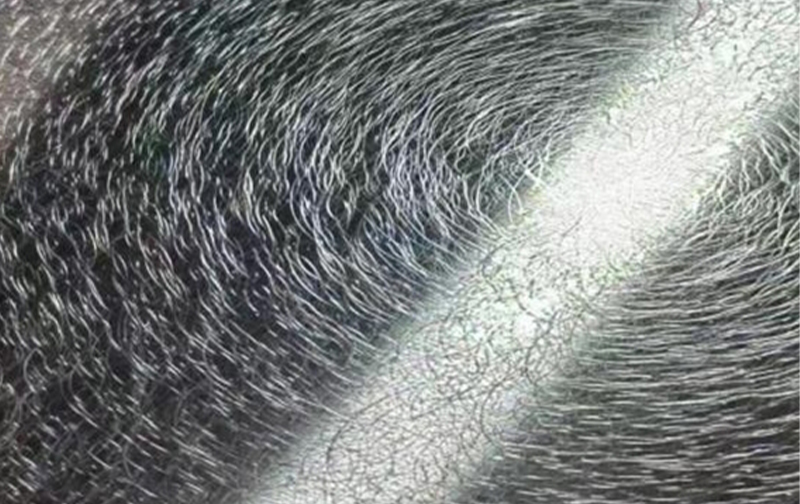 Vortex Pattern